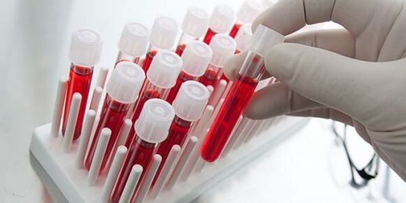 Blood sample